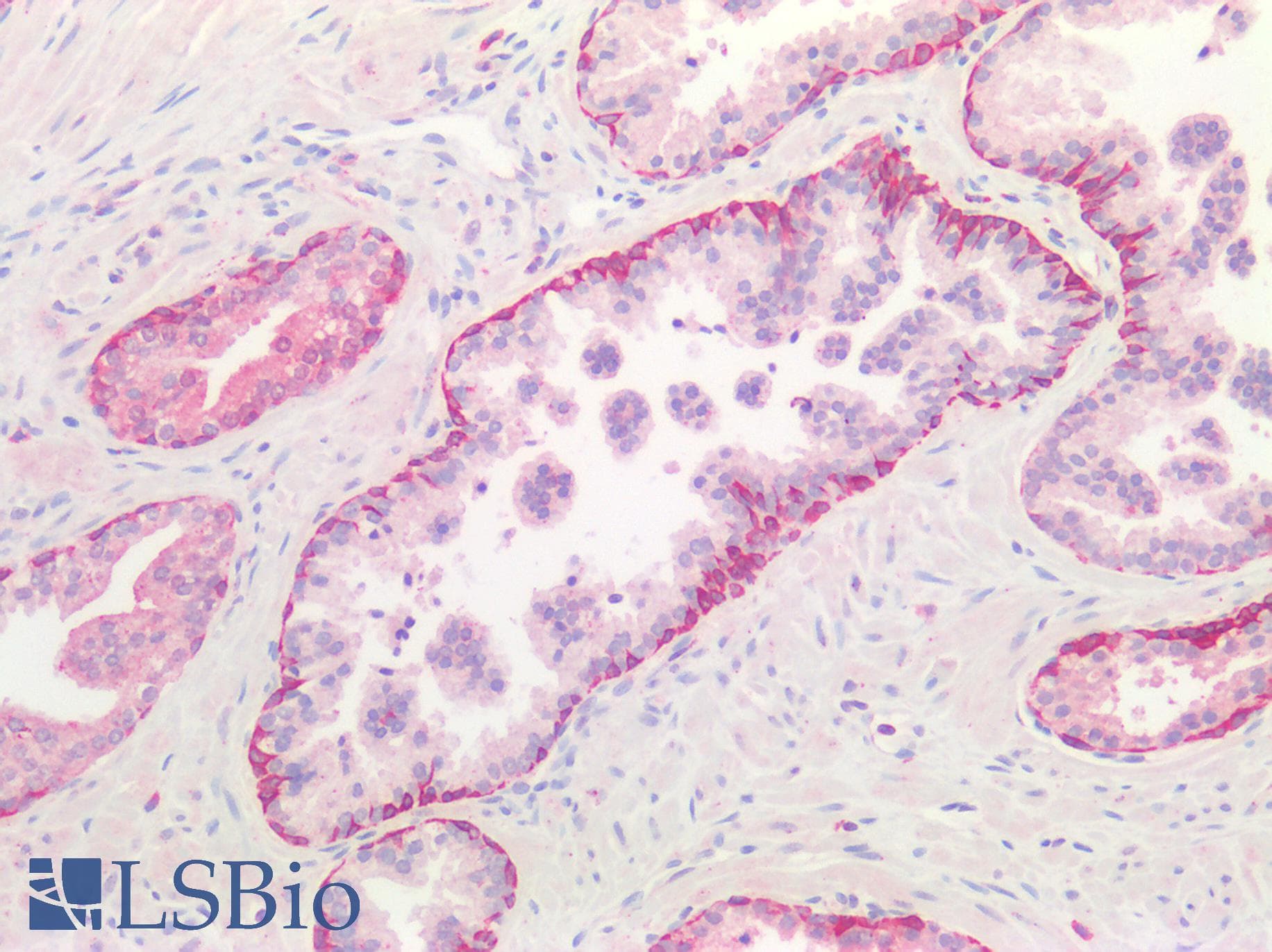 PathPlus™ Polyclonal Goat anti-Human CTSB / Cathepsin B Antibody (Internal Region, IHC, IF, WB)
