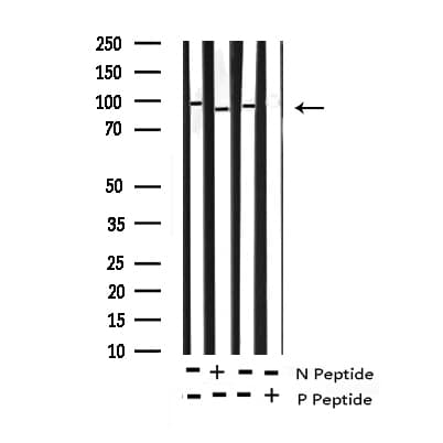 Polyclonal Rabbit anti-Human NBN / Nibrin Antibody (phospho-Ser343, IF, WB)
