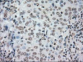 PLK1 / PLK-1 Antibody (clone OTI1D4)