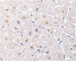 TNFRSF6B / DCR3 Antibody (N-Terminus)