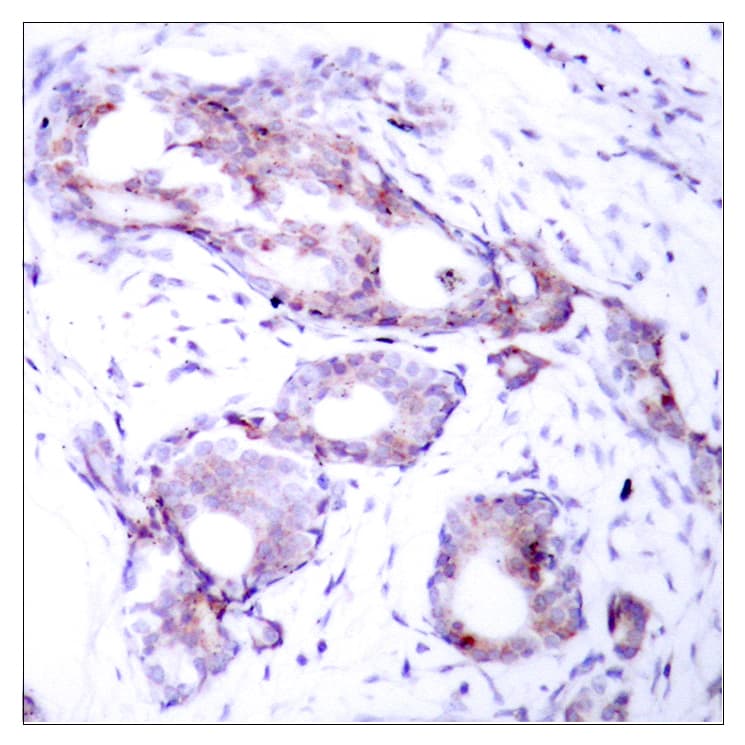 MYC / c-Myc Antibody (phospho-Ser373)