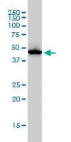 ADA / Adenosine Deaminase Antibody (clone 4G4-1C6)