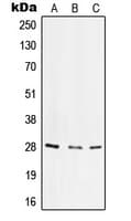ITGA6/Integrin Alpha 6/CD49f Antibody (C-Terminus)