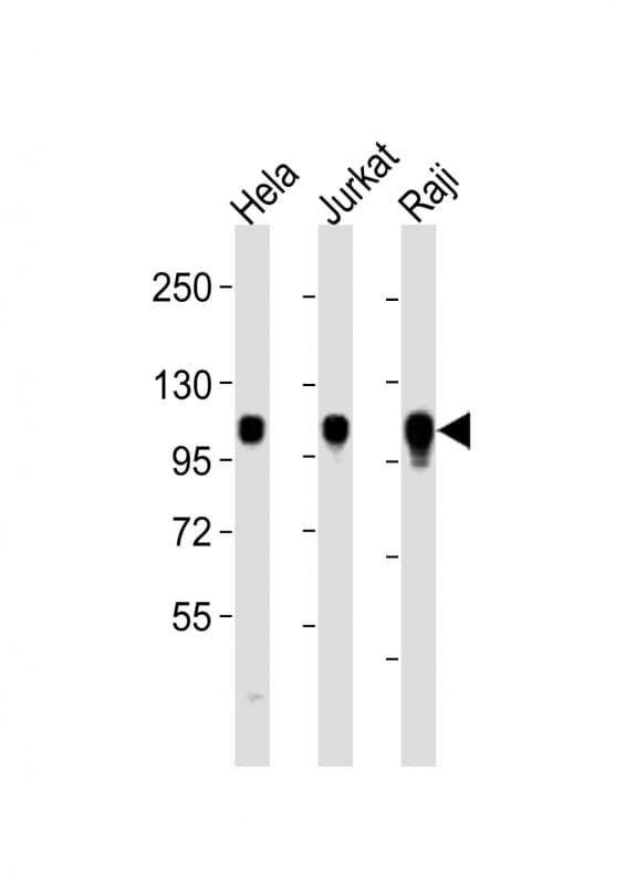 ITGA7 / Integrin Alpha 7 Antibody (aa1149-1181)