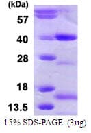 Human NTHL1 Protein (Recombinant His)