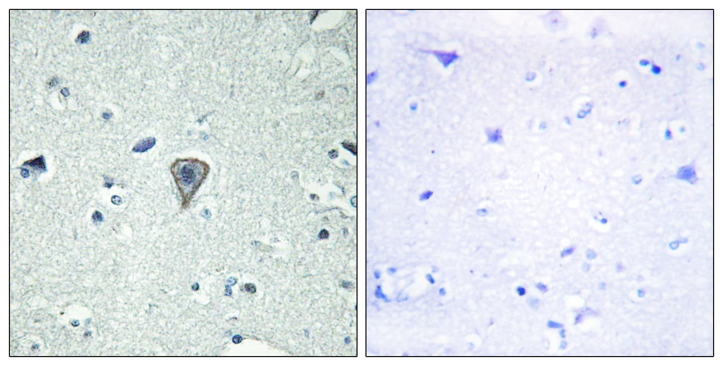 GPR37L1 Antibody (aa1-50)