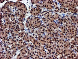 Monoclonal Mouse anti-Human RFXANK Antibody (clone OTI2B6, IHC, IF, WB)