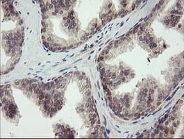 P3H1 / LEPRE1 Antibody (clone OTI1H3)