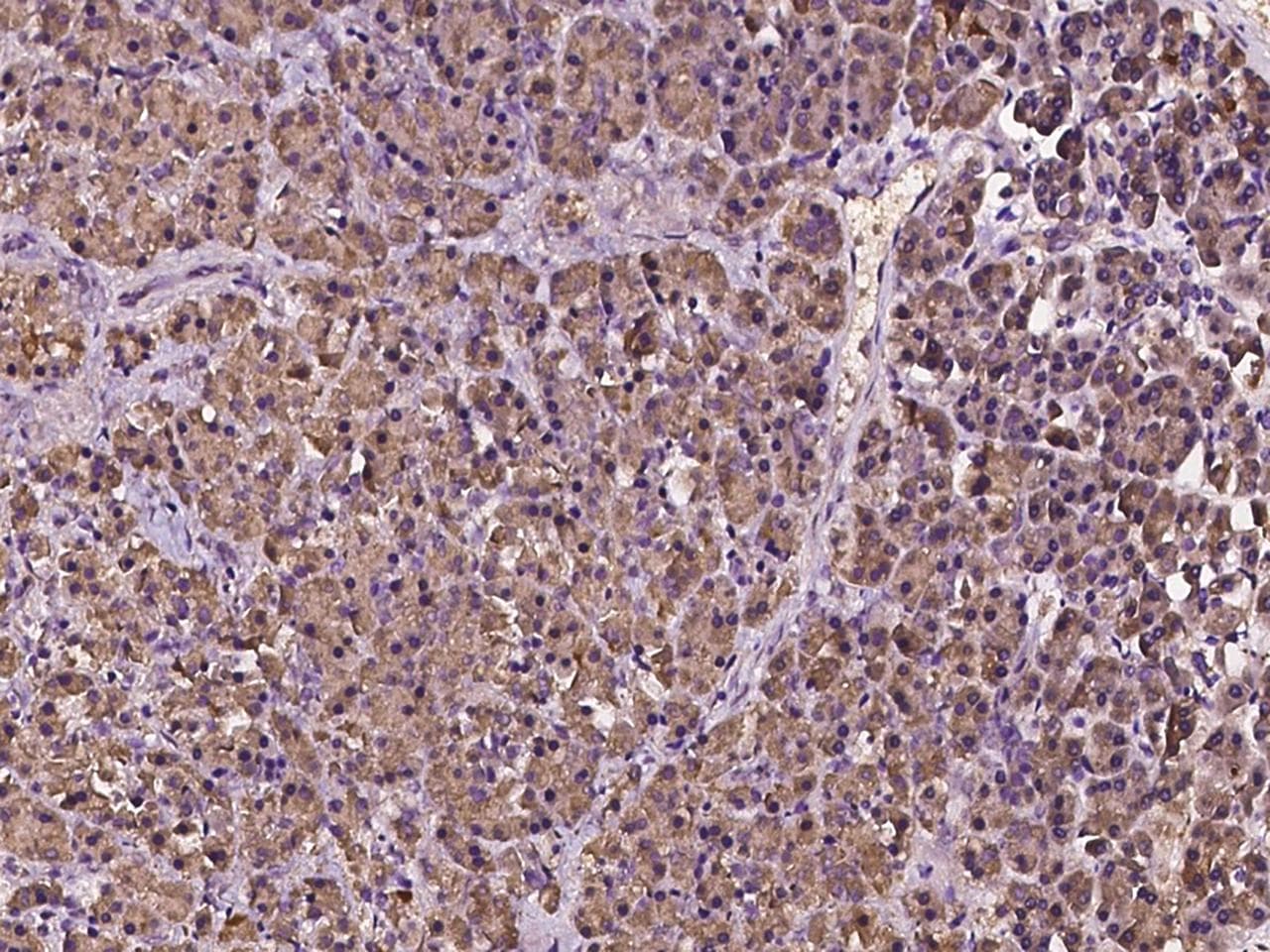 MTMR12 Antibody