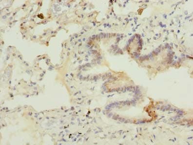 Polyclonal Rabbit anti-Human C7orf61 Antibody (IHC)