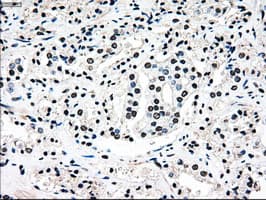 MAP2K4 / MKK4 Antibody (clone OTI1D6)