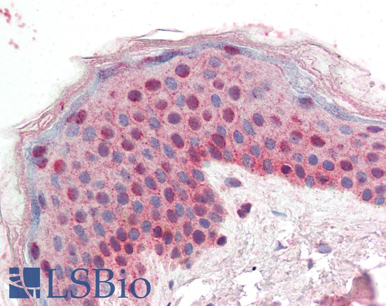IHC-plus™ Polyclonal Goat anti-Human SFN / Stratifin / 14-3-3 Sigma Antibody (aa204-217, IHC, WB)