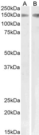 PLA2R / PLA2R1 Antibody (aa946-957)