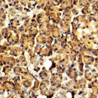 ARSG / Arylsulfatase G Antibody (Internal)