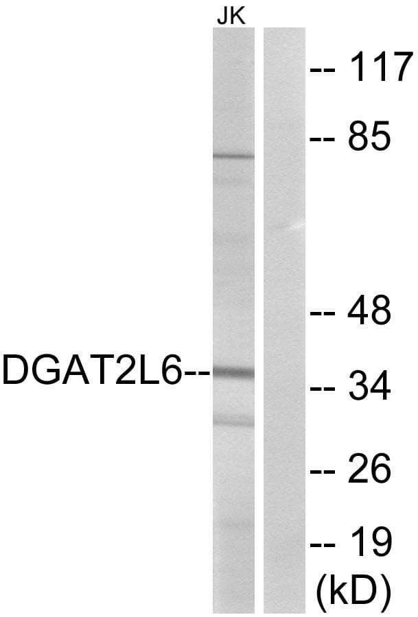 Polyclonal Rabbit anti-Human DGAT2L6 Antibody (WB)