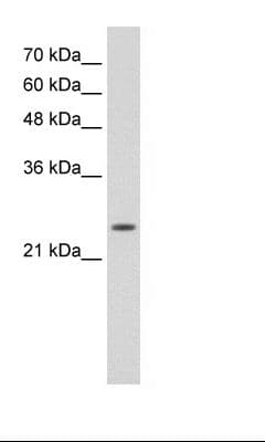 TNNI1 Antibody (N-Terminus)