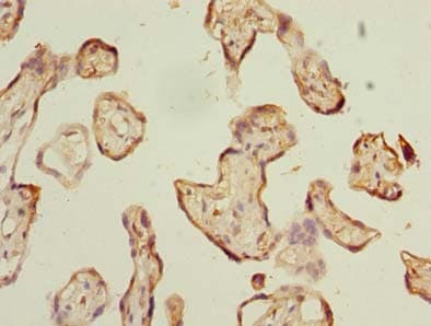 Polyclonal Rabbit anti-Human ABI3 Antibody (IHC, WB)