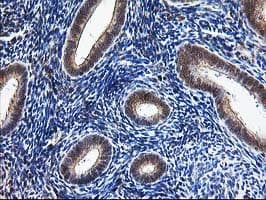 NUDT9 Antibody (clone OTI7A12)