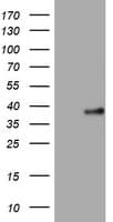PIK3C2A Antibody (aa230-560, clone OTI2E4)