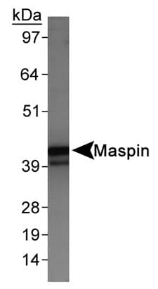 SERPINB5 / Maspin Antibody (Internal, DY650)