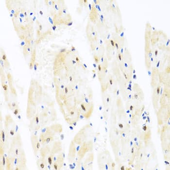 TAF9 Antibody