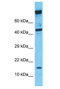 SDHC Antibody (aa1-50)