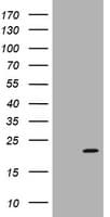 Monoclonal Mouse anti-Human ARPC5 / p16-Arc Antibody (clone 2G1, Carrier-free, IHC, WB)