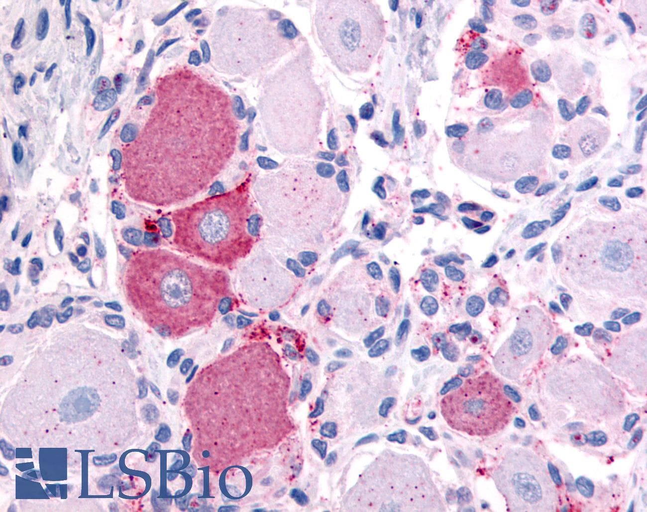 PathPlus™ VRL1 / TRPV2 Antibody (N-Terminus)