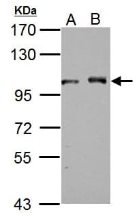 DDX23 / PRP28 Antibody