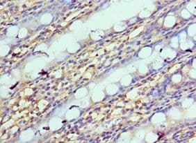 NPR2L / TUSC4 Antibody (aa1-220)