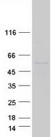 Human SEPT10 /Septin 10 Protein (Recombinant Myc-DDK (Flag))