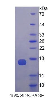 Human ATP4A Protein (Recombinant His)