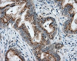 NIT2 Antibody (clone OTI3D5)