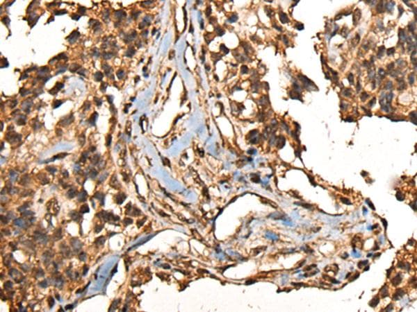 Polyclonal Rabbit anti-Human CAMKK1 Antibody (IHC, WB)
