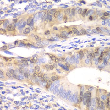 UBCH10 / UBE2C Antibody