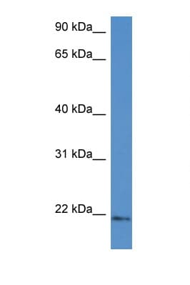 UBE2G1 Antibody (aa44-93)