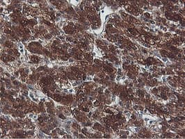 Monoclonal Mouse anti-Human PNPO Antibody (clone OTI1H9, IHC, WB)