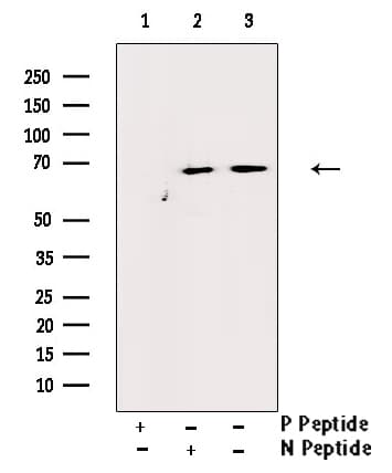 ER Alpha / Estrogen Receptor Antibody (phospho-Tyr537)