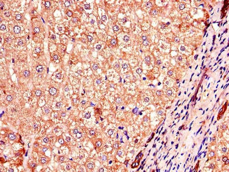 COMMD1 Antibody