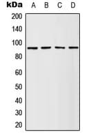 RPS6KA1 / RSK1 Antibody (phospho-Ser380)