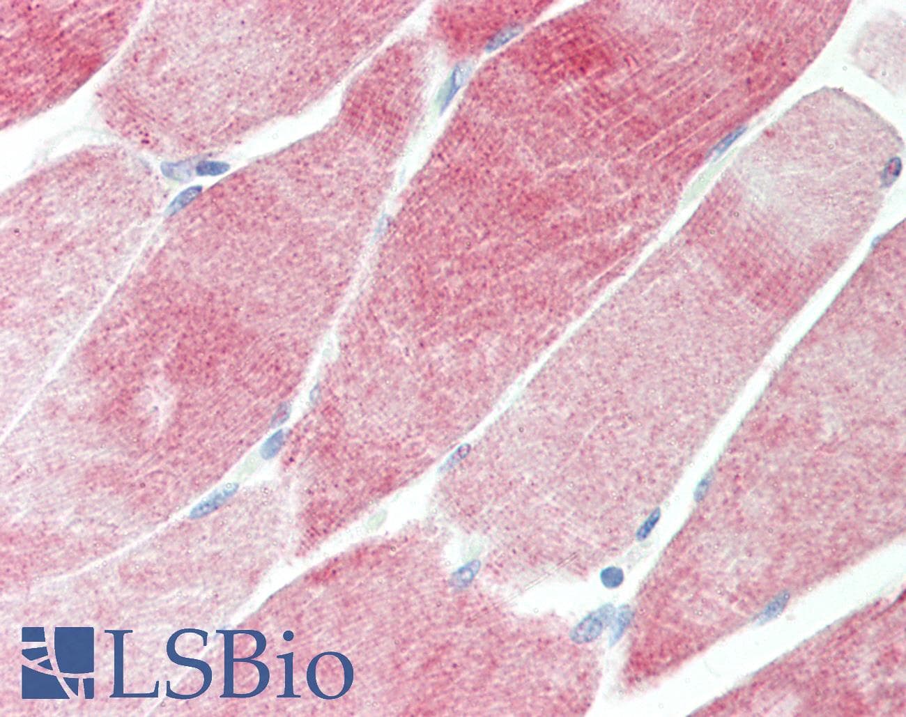 IHC-plus™ Polyclonal Rabbit anti-Human DOK4 Antibody (aa11-60, IHC, WB)