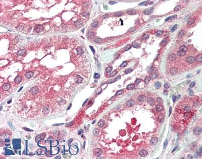 FECH / Ferrochelatase Antibody