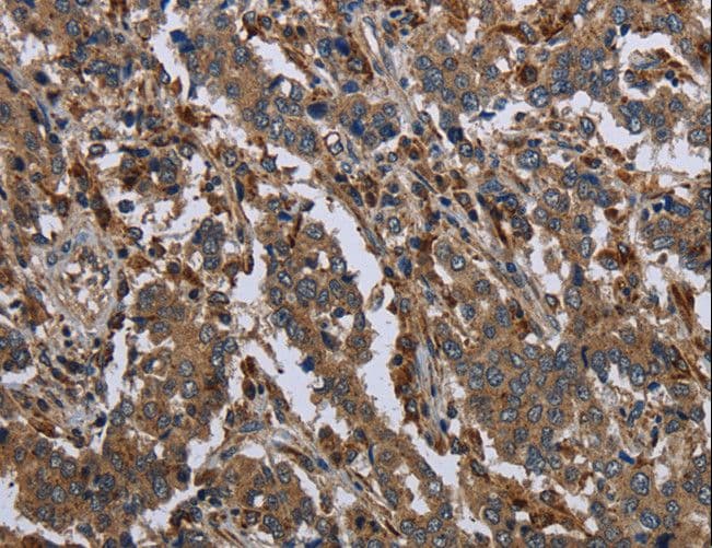 GYS2 Antibody