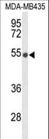 DMC1 Antibody (aa1-30)