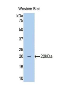 RPN1 / Ribophorin I Antibody (aa24-179, Biotin)