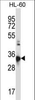 Polyclonal Rabbit anti-Human CCR10 / GPR2 Antibody (aa1-30, WB)