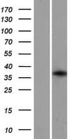 GFI1B Protein (Over-Expression Lysate Myc-DDK (Flag))