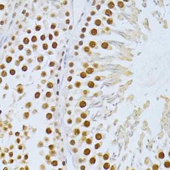 SIRT1 / Sirtuin 1 Antibody
