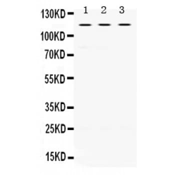 UNC5H3 / UNC5C Antibody (aa894-930)