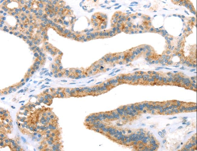 TNIP2 / ABIN-2 Antibody